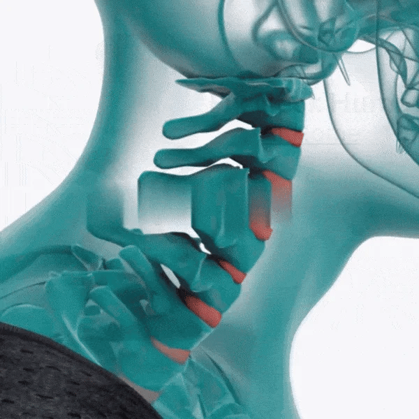 Corrector de Postura Alinnea™