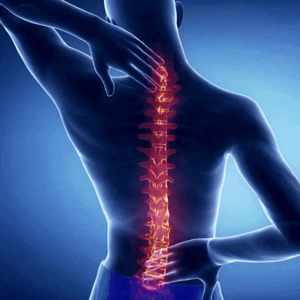 Corrector de Postura Alinnea™